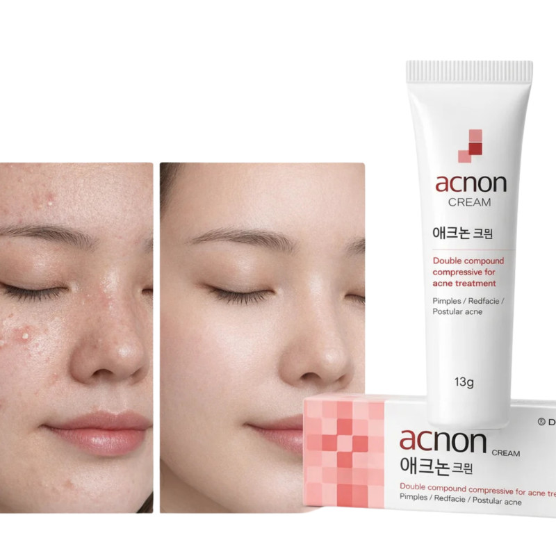 Dong-A Pharm Acnon Cream 13 г